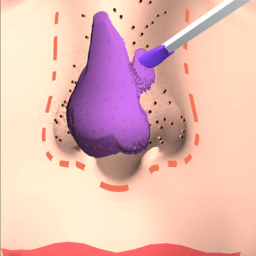 挤黑头大师游戏